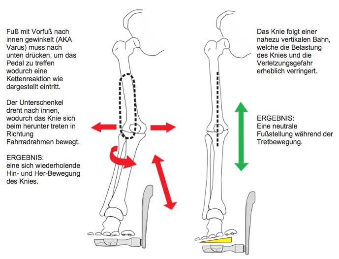 Grafik Knieerhebung